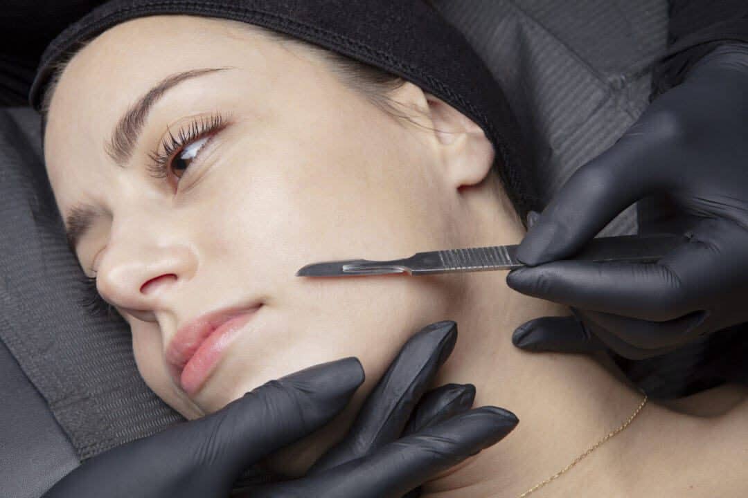 DERMAPLANING In Elkhart by Pam Chaney Aesthetics
