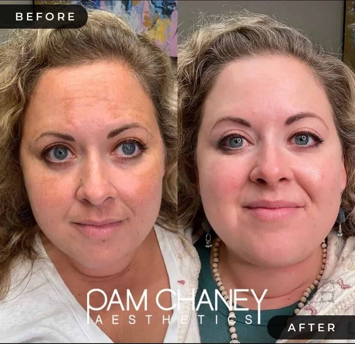 Obagi-Nuderm Pamchaney | Pam Chaney Aesthetics | Elkhart IN