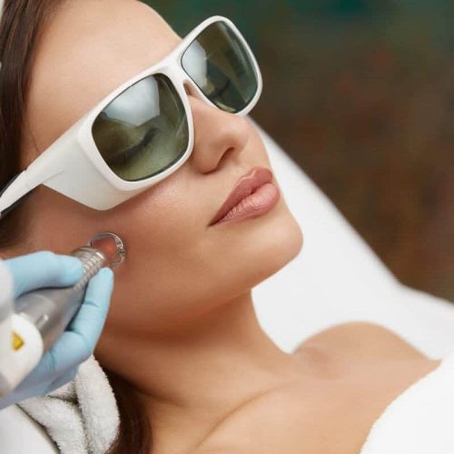 LASER TREATMENTS In Elkhart by Pam Chaney Aesthetics